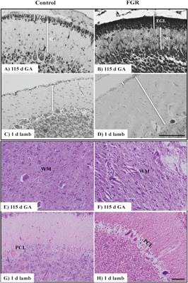 Fetal Growth Restriction Alters Cerebellar Development in Fetal and Neonatal Sheep